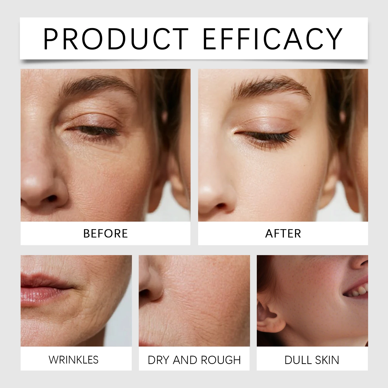 Serum Mikro Jarum Perbaikan Ku - Hyaluronic Acid Facial Serum ulasan dan harga
