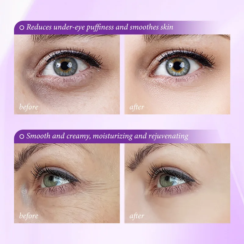 Krim Penghilang Kantung Mata I - Retinol Anti Wrinkle Cream ulasan dan harga
